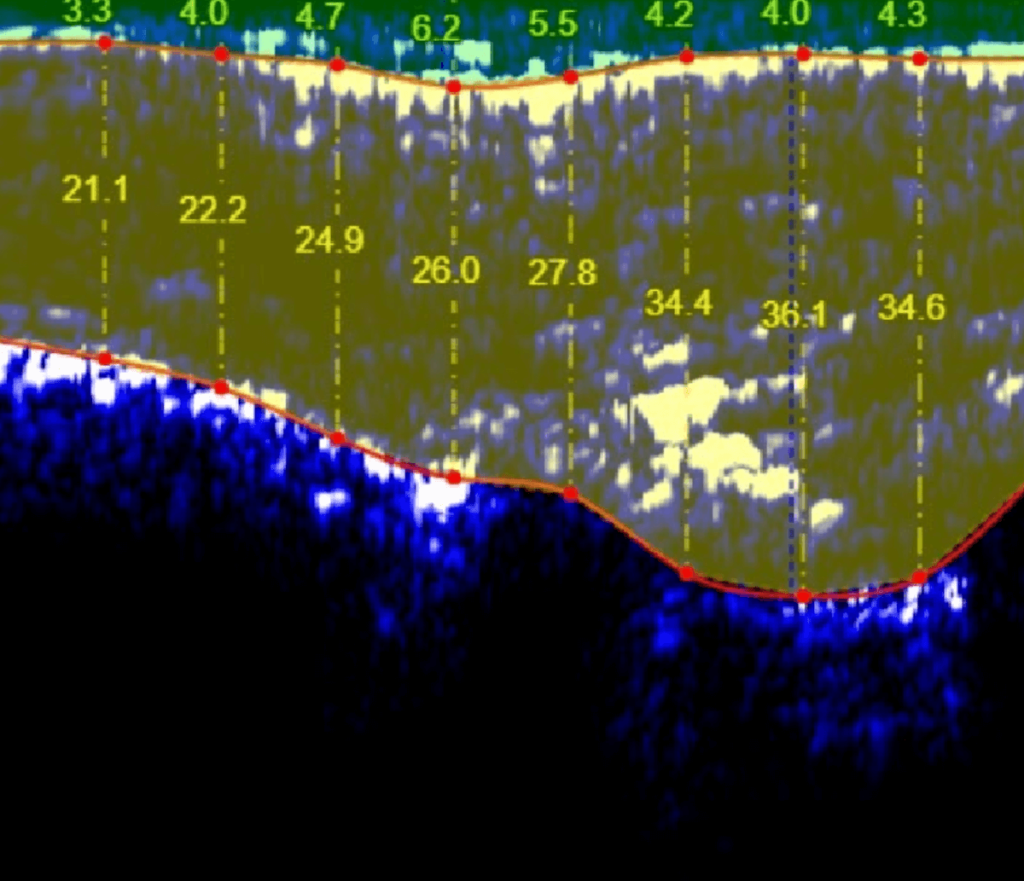 analisi-antropometrica-ecografia2-performanceway
